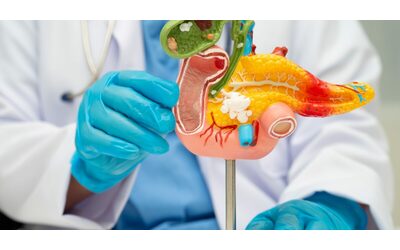 Giornata Mondiale del Tumore al Pancreas Rivizzigno Dieci anni fa era un buco nero Oggi il tasso di sopravvivenza al 13 ma servono ospedali specializzati