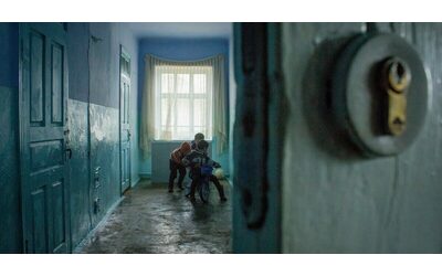 Il rachitismo e lo scorbuto nel Regno Unito la povert infantile causa del ritorno di malattie di et vittoriana