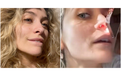 Mostra il naso rovinato dall abuso di droga e festeggia cinque anni senza alcol la nuova vita di Paris Jackson figlia del re del pop Michael IL VIDEO