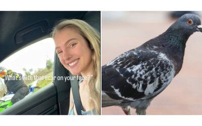 Stavo per essere uccisa da un piccione mi sono miracolosamente svegliata dopo sette giorni di coma la storia di Mercedes Valentine