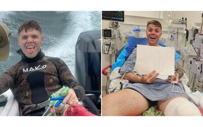 Uno squalo toro di due metri e mezzo mi ha squarciato il ginocchio Senza i miei amici sarei morto il racconto di Chad Armand